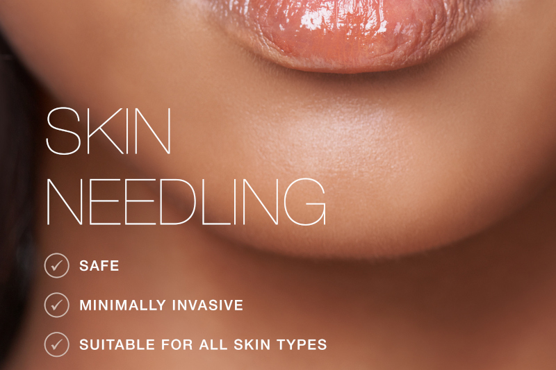Mesopen Microneedling | For Skin of All Ages