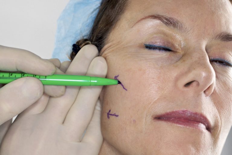 Is a Non-Surgical Facelift Possible?
