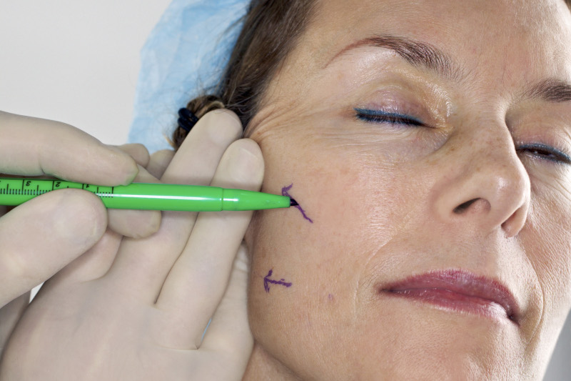 Surgical vs Non Surgical Facelift
